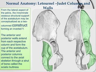 Normal Anatomy: Letournel –Judet Columns and
Walls
From the lateral aspect of
the pelvis, the innominate
osseous structural support
of the acetabulum may be
conceptualized as a twocolumned construct
forming an inverted Y.

The anterior and
posterior walls extend
from each respective
column and form the
cup of the acetabulum.
The anterior and
posterior columns
connect to the axial
skeleton through a strut
of bone called the
sciatic buttress

 