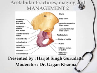 Acetabular Fractures,imaging and
MANAGEMENT 2

Presented by : Harjot Singh Gurudatta
Moderator : Dr. Gagan Khanna

 