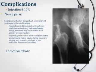 Complications
• Infection 6-10%
• Nerve palsy
•

Sciatic nerve: Kocher-Langenbach approach with
prolonged or forceful traction.
• Femoral nerve: Ilioinguinal approach may
result in traction injury to femoral nerve.
Rarely, the nerve may be lacerated by an
anterior column fracture.
• Superior gluteal nerve: most vulnerable in the
greater sciatic notch. Injury during trauma or
surgery may result in paralysis of hip
abductors with severe disability.

Thromboembolic

 