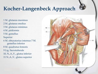 Kocher-Langenbeck Approach
1 M. glutaeus maximus
2 M. glutaeus medius
3 M. glutaeus minimus
4 M. piriformis
5 M. gemellus
Superior
6 M. obturatorius internus 7 M.
gemellus inferior
8 M. quadratus femoris
9 Lig. Sacrotuberale
10, N.,A.,V., glutea inferior
11 N.,A.,V., glutea superior

 