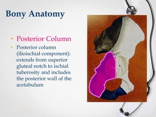 Bony Anatomy
• Posterior Column
• Posterior column
(ilioischial component):
extends from superior
gluteal notch to ischial
tuberosity and includes
the posterior wall of the
acetabulum

 