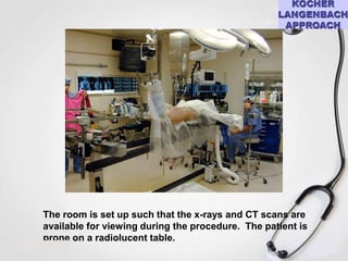 The room is set up such that the x-rays and CT scans are
available for viewing during the procedure. The patient is
prone on a radiolucent table.

 