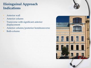 Ilioinguinal Approach
Indications
•
•
•
•
•

Anterior wall
Anterior column
Transverse with significant anterior
displacement
Anterior column/posterior hemitransverse
Both-column

 