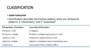 Jude Letournel Classification ACETABULUM And HIP DISLOCATION Report.pptx