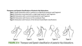 ACETABULUM And HIP DISLOCATION Report.pptx