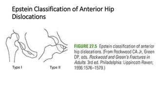 ACETABULUM And HIP DISLOCATION Report.pptx