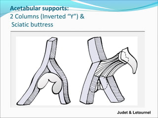 Acetabular supports:
2 Columns (Inverted “Y”) &
Sciatic buttress
Judet & Letournel
 