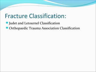 Fracture Classification:
Judet and Letournel Classification
Orthopaedic Trauma Association Classification
 