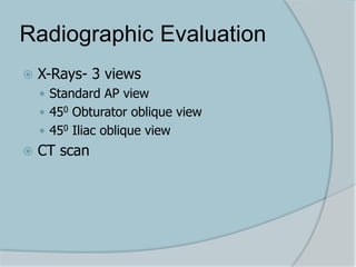 Radiographic Evaluation
 X-Rays- 3 views
 Standard AP view
 450 Obturator oblique view
 450 Iliac oblique view
 CT scan
 