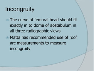 Incongruity
 The curve of femoral head should fit
exactly in to dome of acetabulum in
all three radiographic views
 Matta has recommended use of roof
arc measurements to measure
incongruity
 