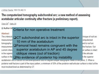 Criteria for non operative treatment
CT subchondral arc is intact in the superior
10 mm of the acetabulum
Femoral head remains congruent with the
superior acetabulum in AP and 45 degree
oblique views (out of traction)
No evidence of posterior hip instability
 