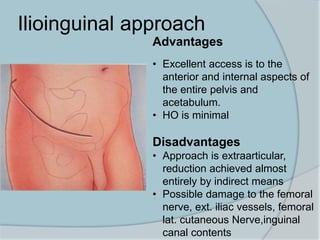 Ilioinguinal approach
Advantages
• Excellent access is to the
anterior and internal aspects of
the entire pelvis and
acetabulum.
• HO is minimal
Disadvantages
• Approach is extraarticular,
reduction achieved almost
entirely by indirect means
• Possible damage to the femoral
nerve, ext. iliac vessels, femoral
lat. cutaneous Nerve,inguinal
canal contents
 
