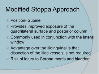 Modified Stoppa Approach
 Position- Supine
 Provides improved exposure of the
quadrilateral surface and posterior column
 Commonly used in conjunction with the lateral
window
 Advantage over the ilioinguinal is that
dissection of the iliac vessels is not required
 Risk of injury to Corona mortis and bladder
 
