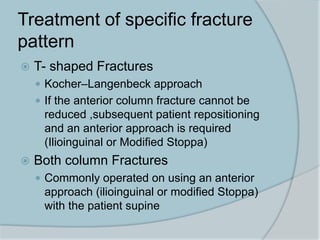 Treatment of specific fracture
pattern
 T- shaped Fractures
 Kocher–Langenbeck approach
 If the anterior column fracture cannot be
reduced ,subsequent patient repositioning
and an anterior approach is required
(Ilioinguinal or Modified Stoppa)
 Both column Fractures
 Commonly operated on using an anterior
approach (ilioinguinal or modified Stoppa)
with the patient supine
 