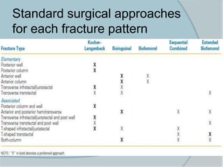 Standard surgical approaches
for each fracture pattern
 