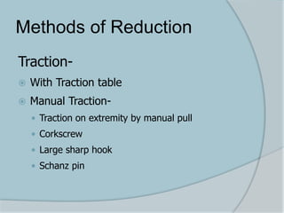 Methods of Reduction
Traction-
 With Traction table
 Manual Traction-
 Traction on extremity by manual pull
 Corkscrew
 Large sharp hook
 Schanz pin
 
