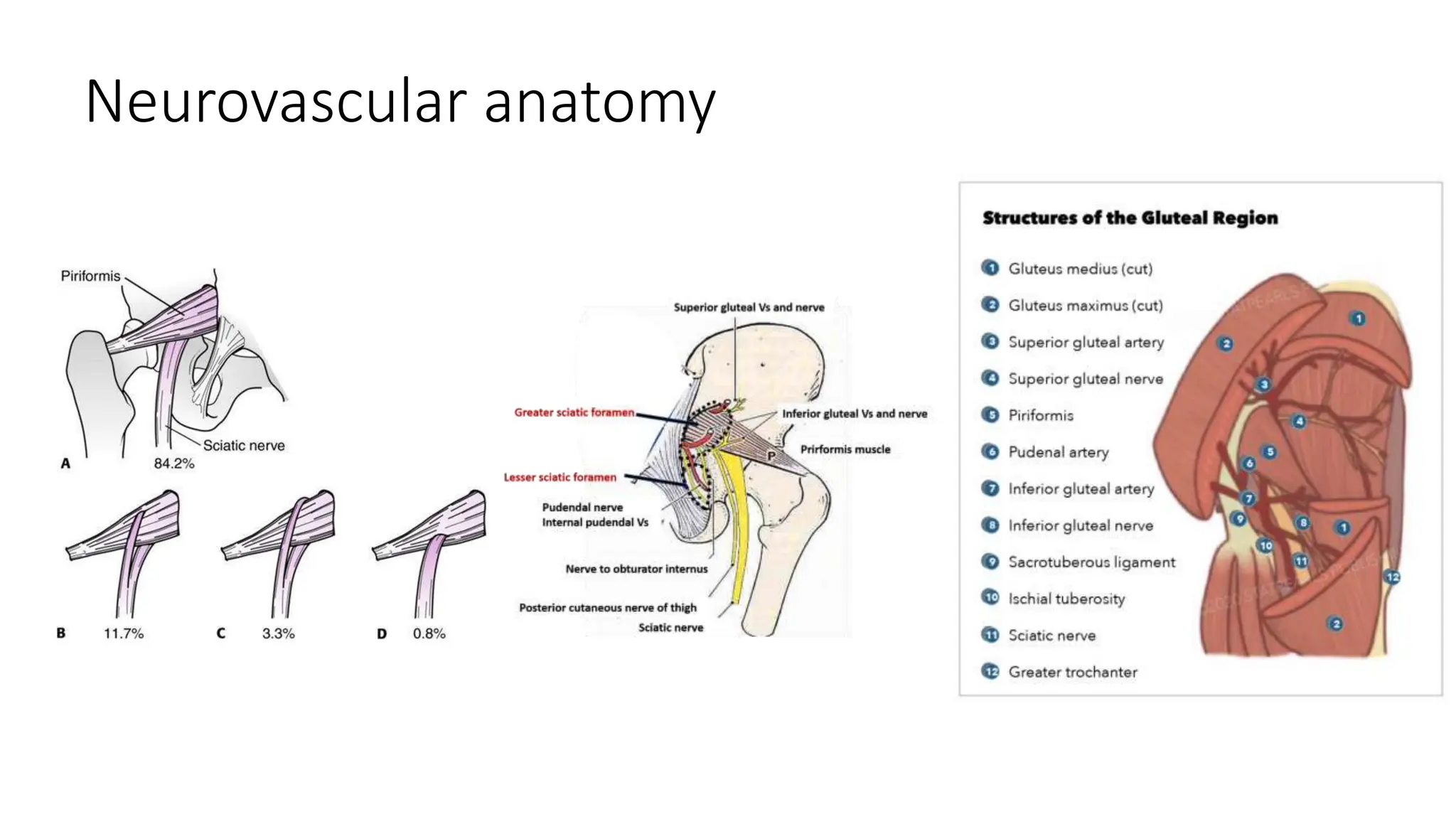 Acetabulum Fractures - Anatomy, Radiological Evaluation, Classification ...