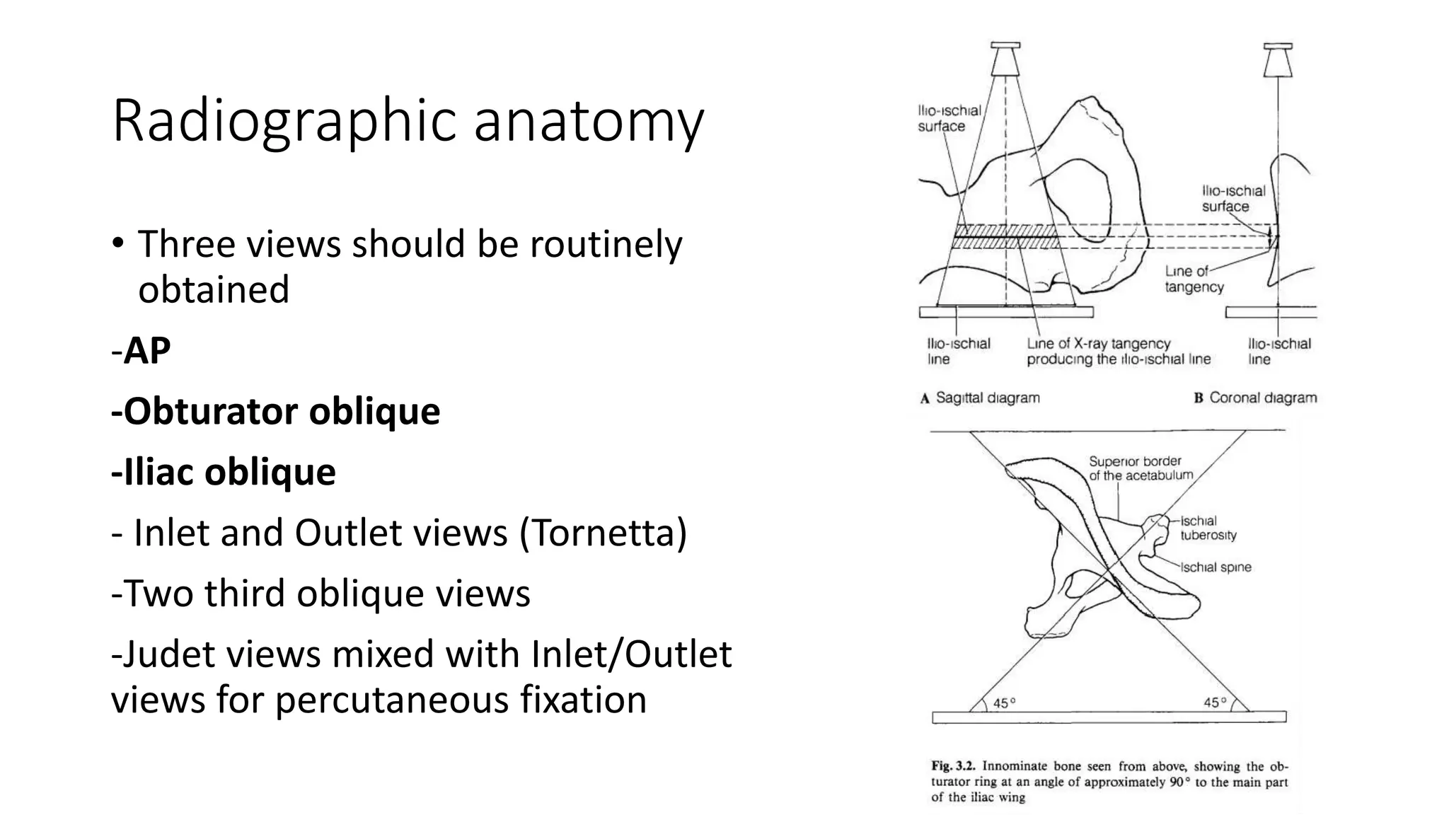 Acetabulum Fractures - Anatomy, Radiological Evaluation, Classification ...