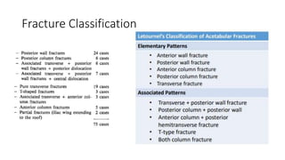 Acetabulum Fractures - Anatomy, Radiological Evaluation, Classification ...
