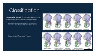 Acetabulum Fractures in Pediatrics pptx Acetabulum Fractures in Pediatrics pptx
