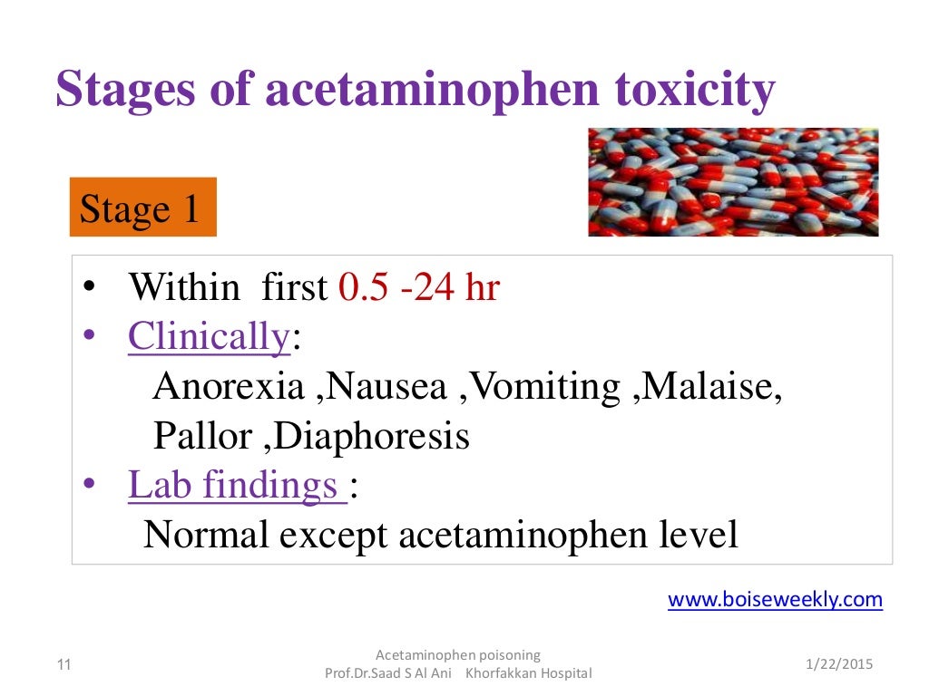 Acetaminophen poisoning