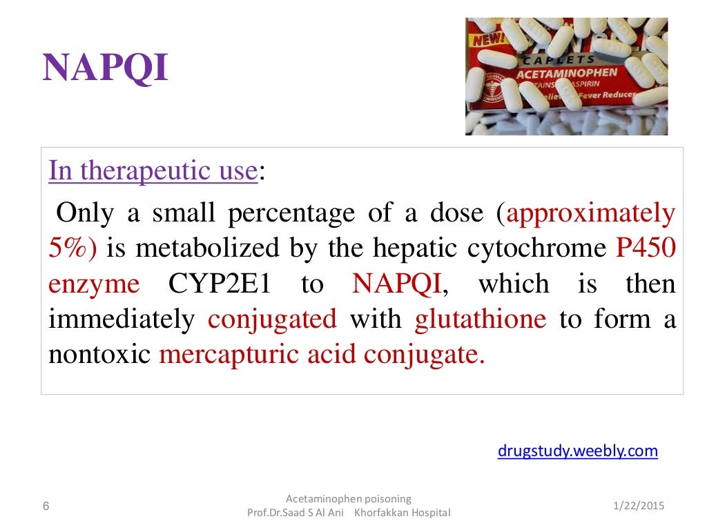 Acetaminophen poisoning