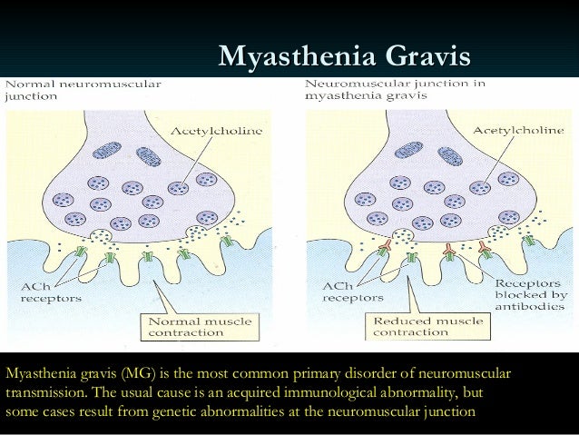 Acetylcholinesterase Inhibitors Dr Rahul Kunkulol