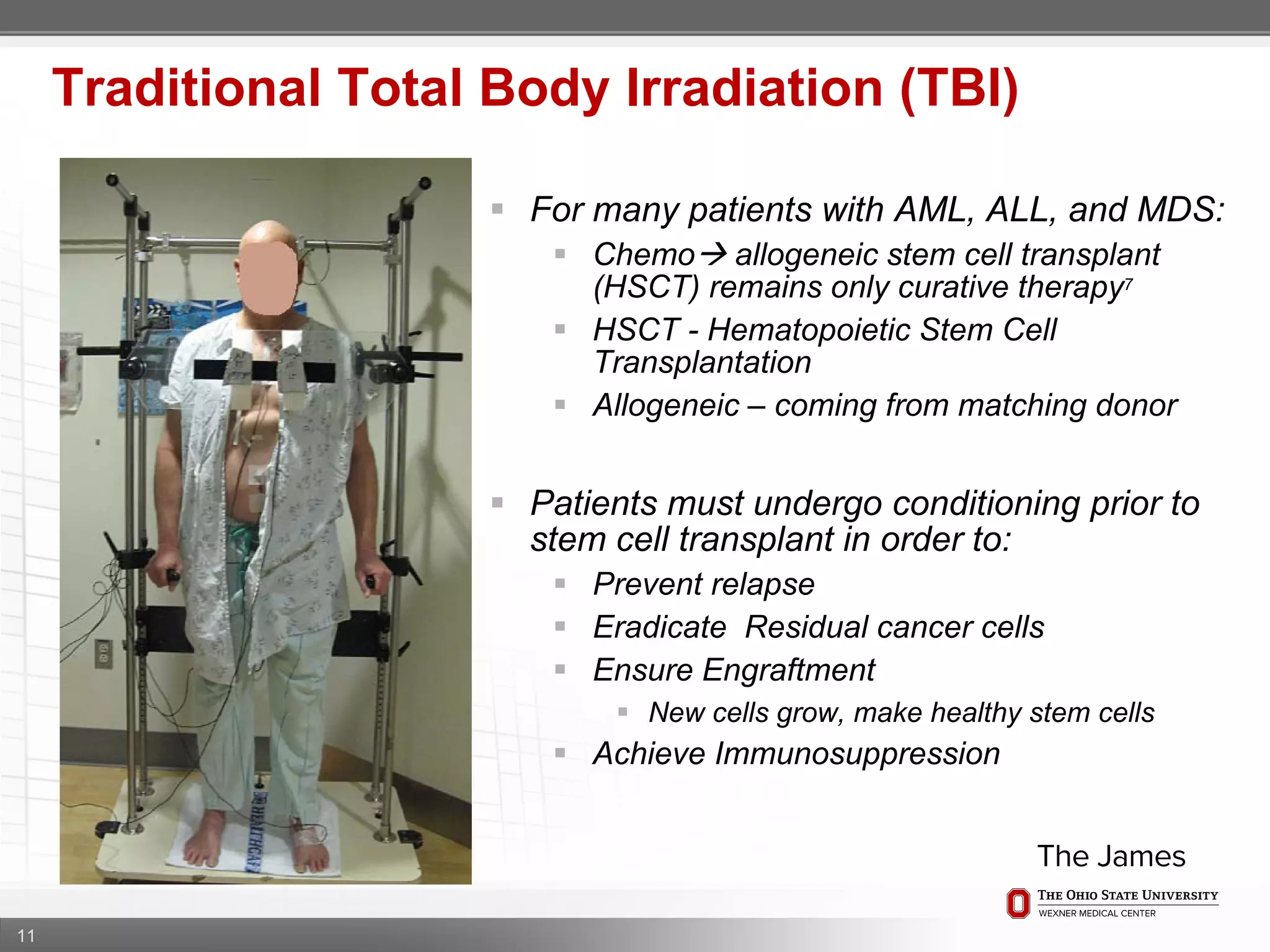 11
Traditional Total Body Irradiation (TBI)
 For many patients with AML, ALL, and MDS:
 Chemo allogeneic stem cell transplant
(HSCT) remains only curative therapy7
 HSCT - Hematopoietic Stem Cell
Transplantation
 Allogeneic – coming from matching donor
 Patients must undergo conditioning prior to
stem cell transplant in order to:
 Prevent relapse
 Eradicate Residual cancer cells
 Ensure Engraftment
 New cells grow, make healthy stem cells
 Achieve Immunosuppression
 