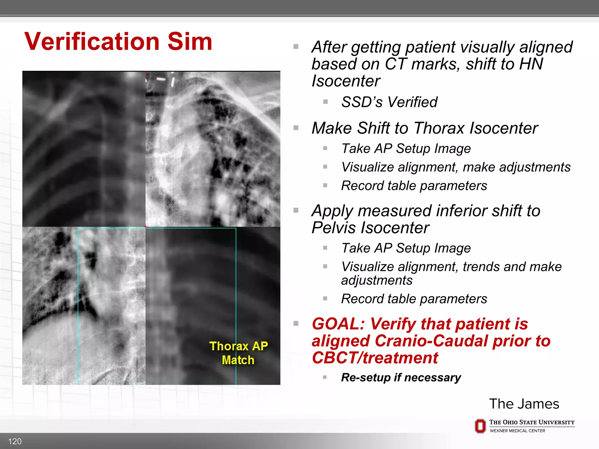 120
Verification Sim  After getting patient visually aligned
based on CT marks, shift to HN
Isocenter
 SSD’s Verified
 Make Shift to Thorax Isocenter
 Take AP Setup Image
 Visualize alignment, make adjustments
 Record table parameters
 Apply measured inferior shift to
Pelvis Isocenter
 Take AP Setup Image
 Visualize alignment, trends and make
adjustments
 Record table parameters
 GOAL: Verify that patient is
aligned Cranio-Caudal prior to
CBCT/treatment
 Re-setup if necessary
 