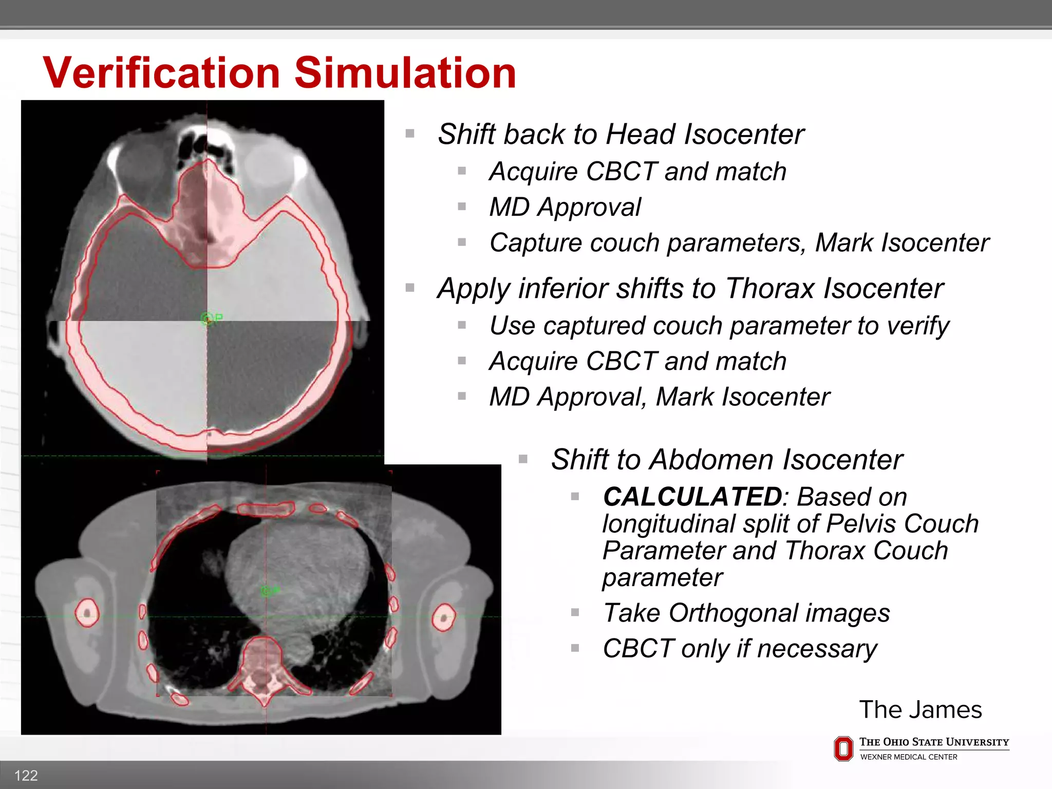 122
Verification Simulation
 Shift back to Head Isocenter
 Acquire CBCT and match
 MD Approval
 Capture couch parameters, Mark Isocenter
 Apply inferior shifts to Thorax Isocenter
 Use captured couch parameter to verify
 Acquire CBCT and match
 MD Approval, Mark Isocenter
 Shift to Abdomen Isocenter
 CALCULATED: Based on
longitudinal split of Pelvis Couch
Parameter and Thorax Couch
parameter
 Take Orthogonal images
 CBCT only if necessary
 