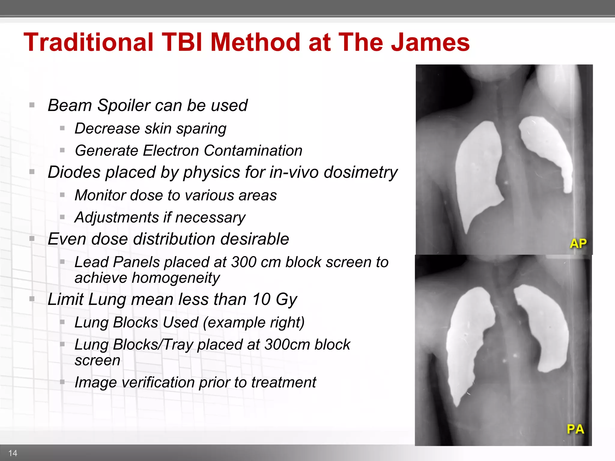 14
 Beam Spoiler can be used
 Decrease skin sparing
 Generate Electron Contamination
 Diodes placed by physics for in-vivo dosimetry
 Monitor dose to various areas
 Adjustments if necessary
 Even dose distribution desirable
 Lead Panels placed at 300 cm block screen to
achieve homogeneity
 Limit Lung mean less than 10 Gy
 Lung Blocks Used (example right)
 Lung Blocks/Tray placed at 300cm block
screen
 Image verification prior to treatment
Traditional TBI Method at The James
 