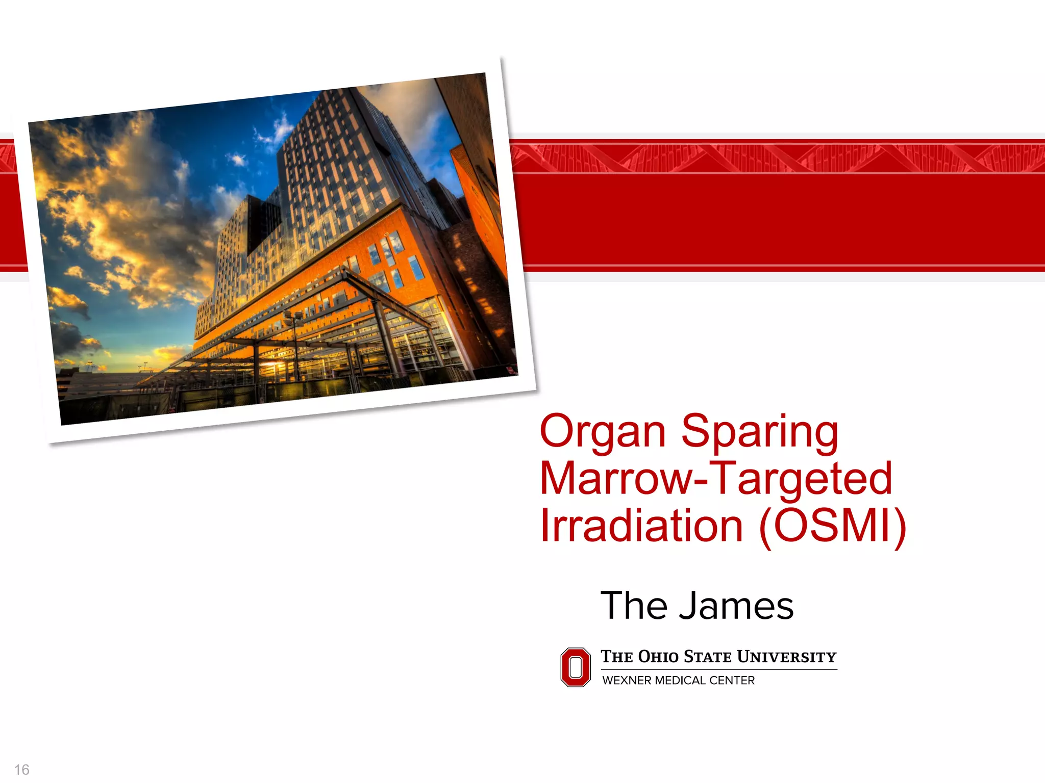 Organ Sparing
Marrow-Targeted
Irradiation (OSMI)
16
 