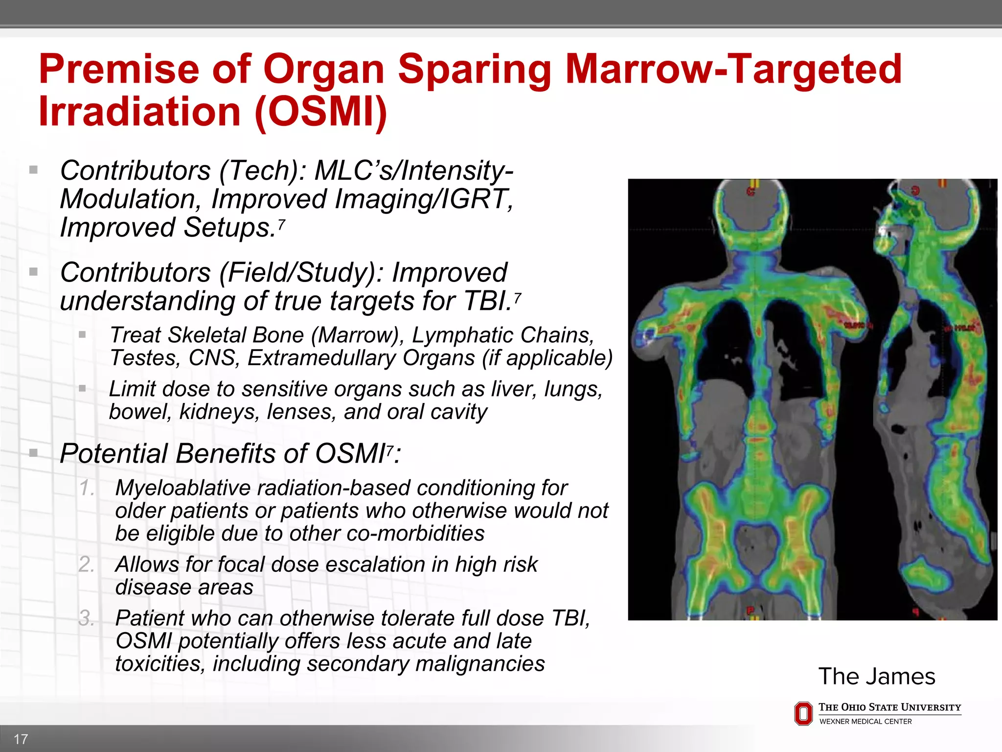 17
Premise of Organ Sparing Marrow-Targeted
Irradiation (OSMI)
 Contributors (Tech): MLC’s/Intensity-
Modulation, Improved Imaging/IGRT,
Improved Setups.7
 Contributors (Field/Study): Improved
understanding of true targets for TBI.7
 Treat Skeletal Bone (Marrow), Lymphatic Chains,
Testes, CNS, Extramedullary Organs (if applicable)
 Limit dose to sensitive organs such as liver, lungs,
bowel, kidneys, lenses, and oral cavity
 Potential Benefits of OSMI7:
1. Myeloablative radiation-based conditioning for
older patients or patients who otherwise would not
be eligible due to other co-morbidities
2. Allows for focal dose escalation in high risk
disease areas
3. Patient who can otherwise tolerate full dose TBI,
OSMI potentially offers less acute and late
toxicities, including secondary malignancies
 