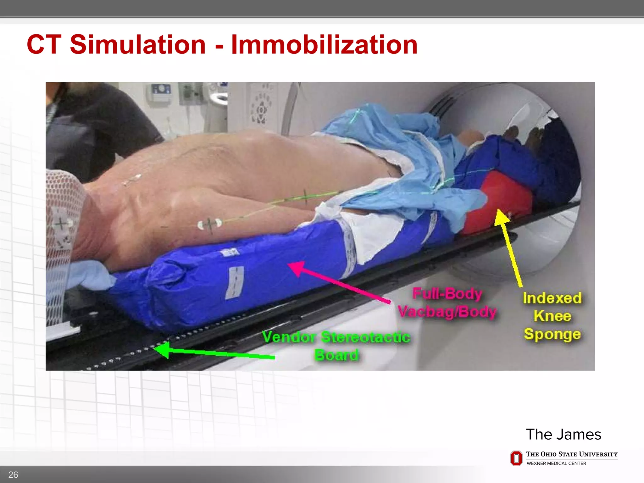 26
CT Simulation - Immobilization
 