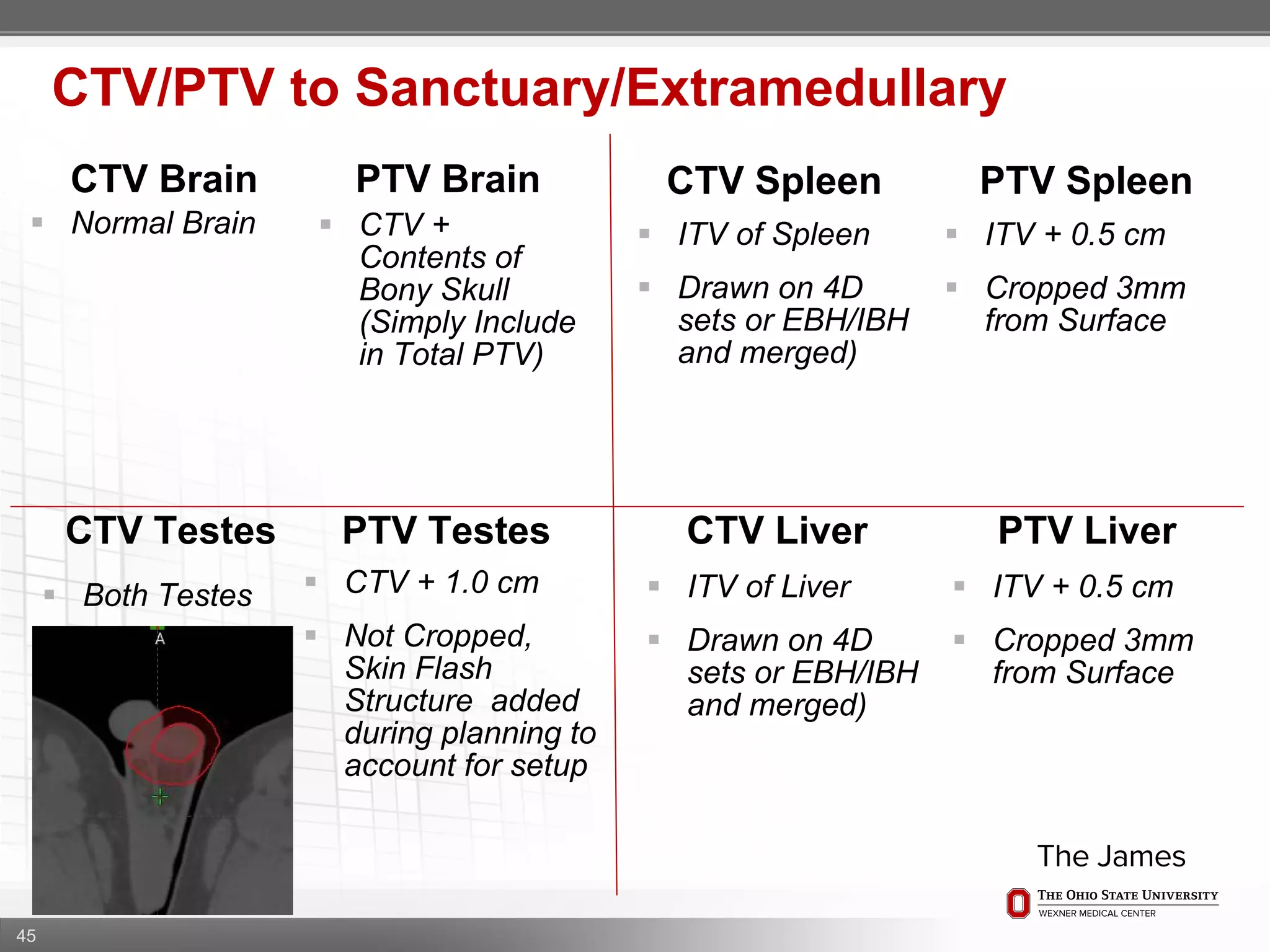 45
CTV/PTV to Sanctuary/Extramedullary
CTV Brain PTV Brain CTV Spleen PTV Spleen
CTV Testes PTV Testes CTV Liver PTV Liver
 Normal Brain  CTV +
Contents of
Bony Skull
(Simply Include
in Total PTV)
 ITV of Spleen
 Drawn on 4D
sets or EBH/IBH
and merged)
 ITV + 0.5 cm
 Cropped 3mm
from Surface
 Both Testes  CTV + 1.0 cm
 Not Cropped,
Skin Flash
Structure added
during planning to
account for setup
 ITV of Liver
 Drawn on 4D
sets or EBH/IBH
and merged)
 ITV + 0.5 cm
 Cropped 3mm
from Surface
 
