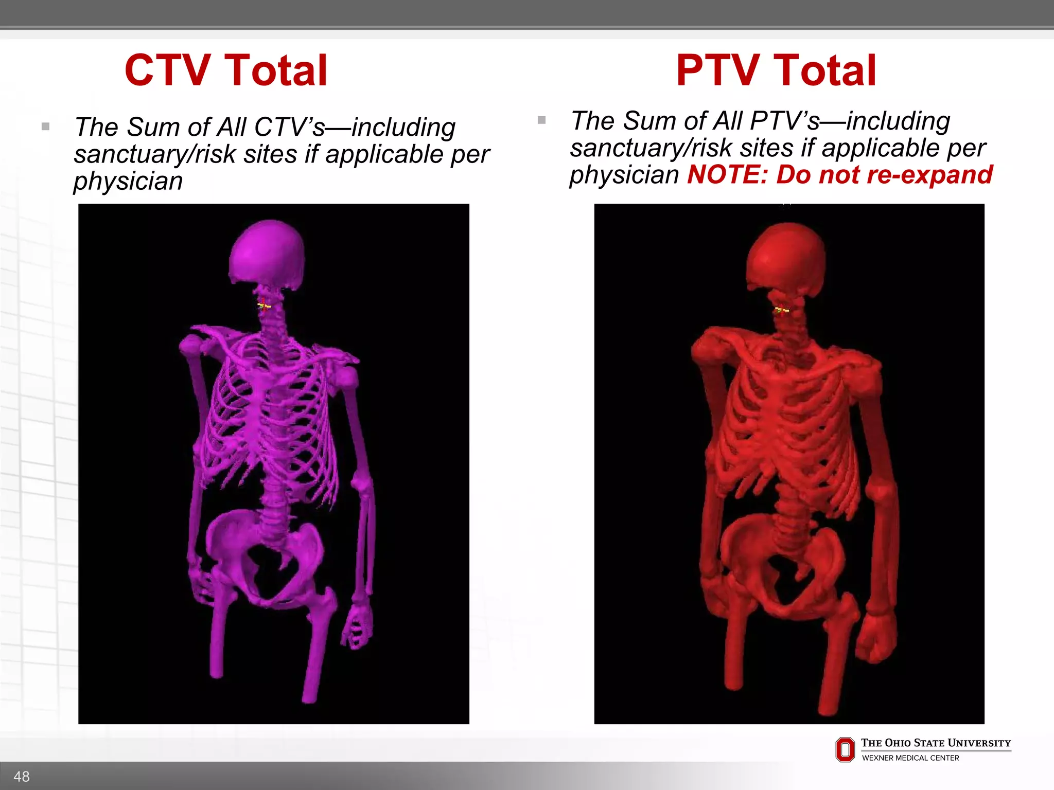 48
CTV Total PTV Total
 The Sum of All PTV’s—including
sanctuary/risk sites if applicable per
physician NOTE: Do not re-expand
 The Sum of All CTV’s—including
sanctuary/risk sites if applicable per
physician
 