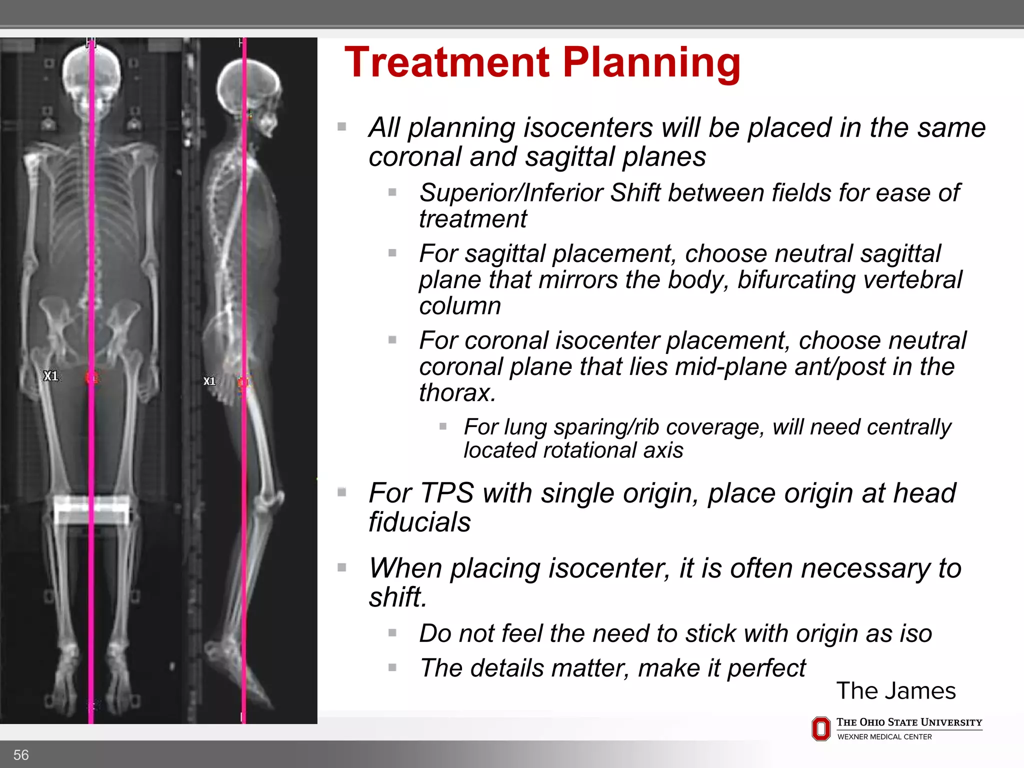  All planning isocenters will be placed in the same
coronal and sagittal planes
 Superior/Inferior Shift between fields for ease of
treatment
 For sagittal placement, choose neutral sagittal
plane that mirrors the body, bifurcating vertebral
column
 For coronal isocenter placement, choose neutral
coronal plane that lies mid-plane ant/post in the
thorax.
 For lung sparing/rib coverage, will need centrally
located rotational axis
 For TPS with single origin, place origin at head
fiducials
 When placing isocenter, it is often necessary to
shift.
 Do not feel the need to stick with origin as iso
 The details matter, make it perfect
56
Treatment Planning
 