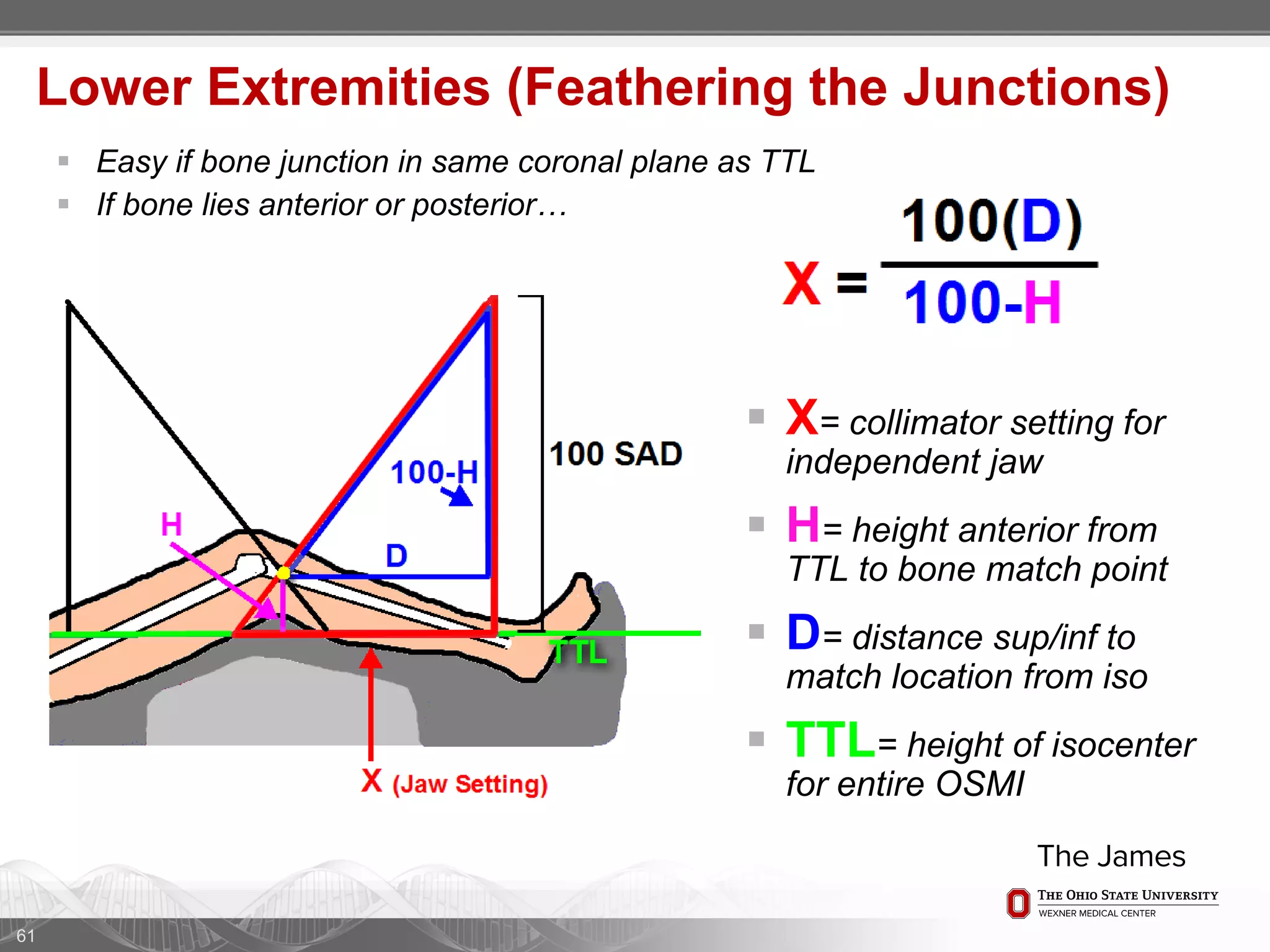 61
 X= collimator setting for
independent jaw
 H= height anterior from
TTL to bone match point
 D= distance sup/inf to
match location from iso
 TTL= height of isocenter
for entire OSMI
Lower Extremities (Feathering the Junctions)
 Easy if bone junction in same coronal plane as TTL
 If bone lies anterior or posterior…
 