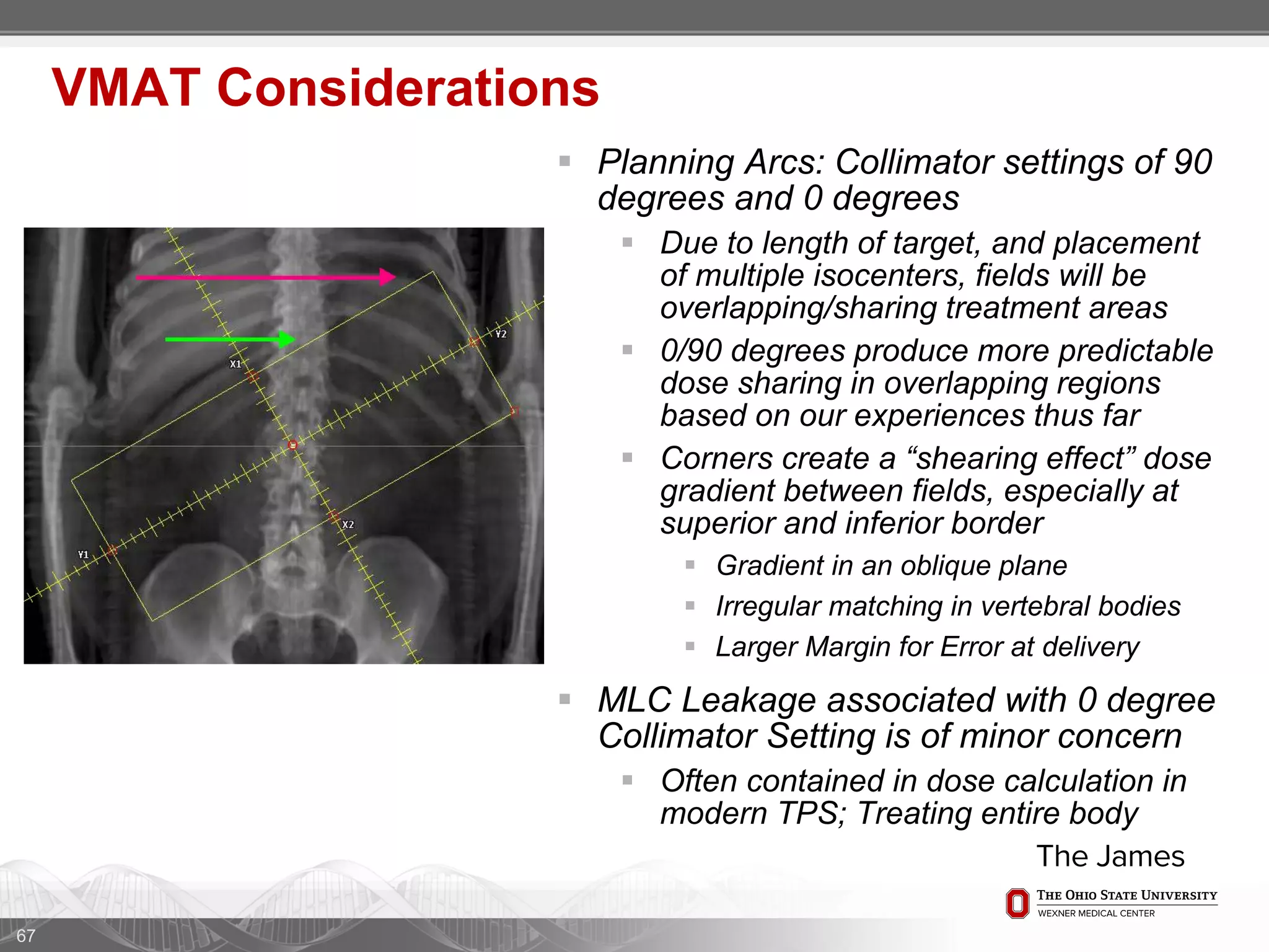  Planning Arcs: Collimator settings of 90
degrees and 0 degrees
 Due to length of target, and placement
of multiple isocenters, fields will be
overlapping/sharing treatment areas
 0/90 degrees produce more predictable
dose sharing in overlapping regions
based on our experiences thus far
 Corners create a “shearing effect” dose
gradient between fields, especially at
superior and inferior border
 Gradient in an oblique plane
 Irregular matching in vertebral bodies
 Larger Margin for Error at delivery
 MLC Leakage associated with 0 degree
Collimator Setting is of minor concern
 Often contained in dose calculation in
modern TPS; Treating entire body
67
VMAT Considerations
 