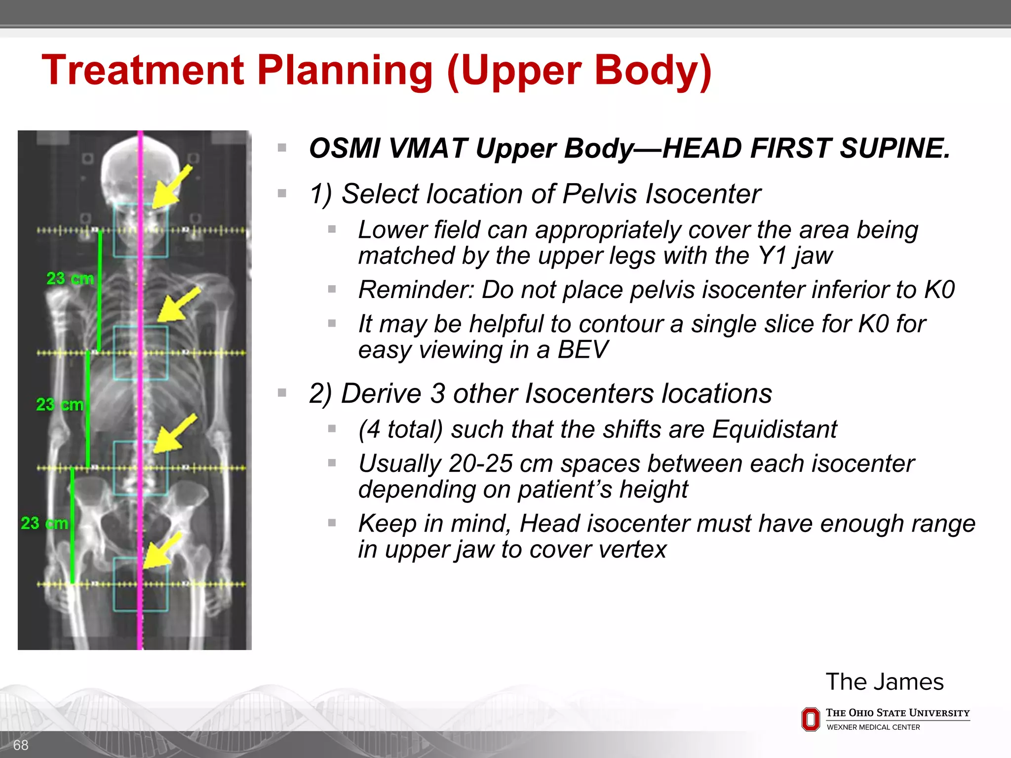  OSMI VMAT Upper Body—HEAD FIRST SUPINE.
 1) Select location of Pelvis Isocenter
 Lower field can appropriately cover the area being
matched by the upper legs with the Y1 jaw
 Reminder: Do not place pelvis isocenter inferior to K0
 It may be helpful to contour a single slice for K0 for
easy viewing in a BEV
 2) Derive 3 other Isocenters locations
 (4 total) such that the shifts are Equidistant
 Usually 20-25 cm spaces between each isocenter
depending on patient’s height
 Keep in mind, Head isocenter must have enough range
in upper jaw to cover vertex
68
Treatment Planning (Upper Body)
 