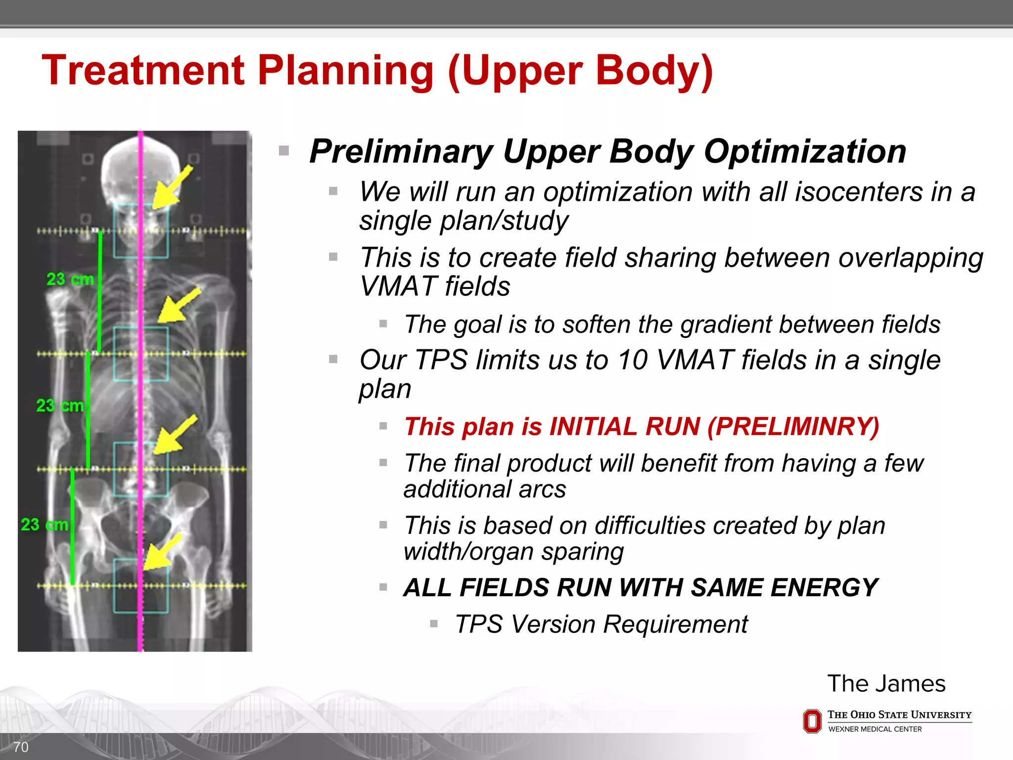  Preliminary Upper Body Optimization
 We will run an optimization with all isocenters in a
single plan/study
 This is to create field sharing between overlapping
VMAT fields
 The goal is to soften the gradient between fields
 Our TPS limits us to 10 VMAT fields in a single
plan
 This plan is INITIAL RUN (PRELIMINRY)
 The final product will benefit from having a few
additional arcs
 This is based on difficulties created by plan
width/organ sparing
 ALL FIELDS RUN WITH SAME ENERGY
 TPS Version Requirement
70
Treatment Planning (Upper Body)
 