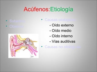 Acúfenos:Etiología
• Subjetivo
• Objetivo
• Causas otológicas
- Oído externo
- Oído medio
- Oído interno
- Vías auditivas
• Causas no otológicas
 