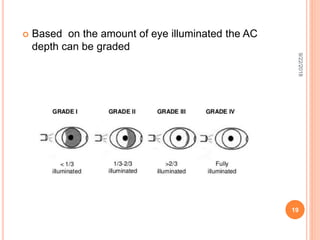 Anterior Chamber : Anatomy , Aqueous Production & Drainage | PPTX