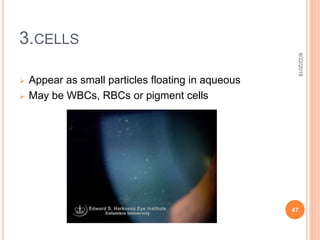 Cells In Ac Anterior Chamber : Anatomy , Aqueous Production & Drainage | PPTX