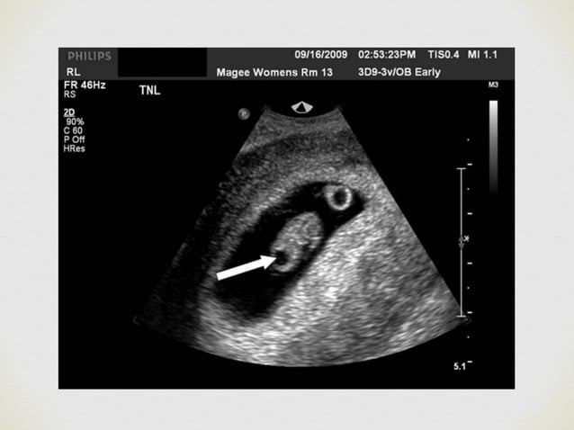 obstetric ultrasound | PDF | Infertility | Reproductive Health