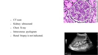  CT scan
 Kidney ultrasound
 Chest X-ray
 Intravenous pyelogram
 Renal biopsy is not indicated.
 