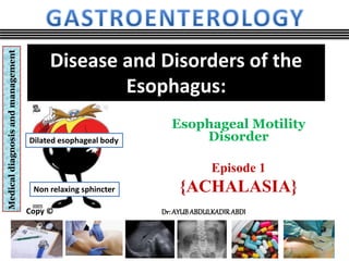 Medicaldiagnosisandmanagement
Copy ©
Disease and Disorders of the
Esophagus:
Esophageal Motility
Disorder
Episode 1
{ACHALASIA}
Dilated esophageal body
Non relaxing sphincter
Dr: AYUBABDULKADIRABDI
 