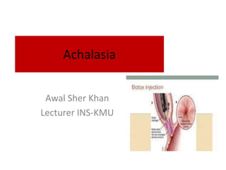 Achalasia
Awal Sher Khan
Lecturer INS-KMU
 