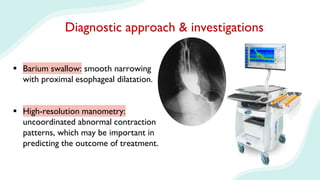 Diagnostic approach & investigations
 Barium swallow: smooth narrowing
with proximal esophageal dilatation.
 High-resolution manometry:
uncoordinated abnormal contraction
patterns, which may be important in
predicting the outcome of treatment.
 