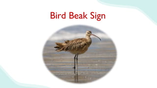 Bird Beak Sign
 